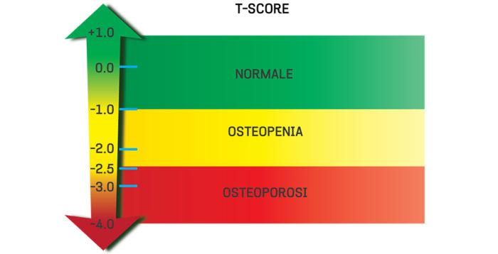 Osteoporosis FIROMMS Osteoporosis FIROMMS